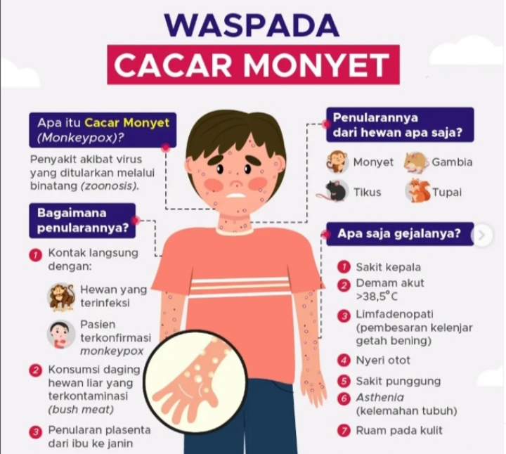 Cacar Monyet Bisa Menular Melalui Jabat Tangan dan Pakaian